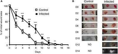 IL-17 and IL-22 are pivotal cytokines to delay wound healing of S. aureus and P. aeruginosa infected skin